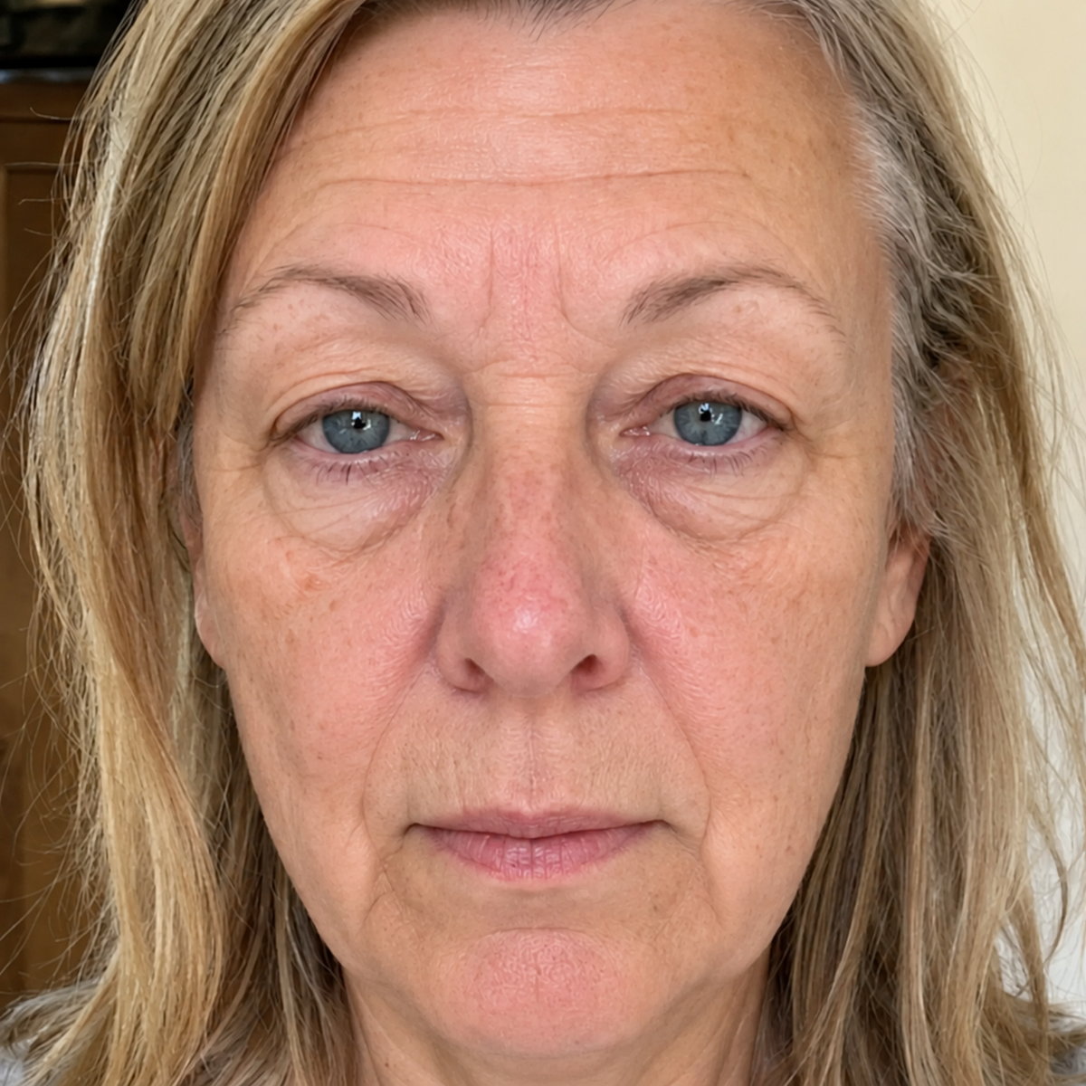 Before treatment