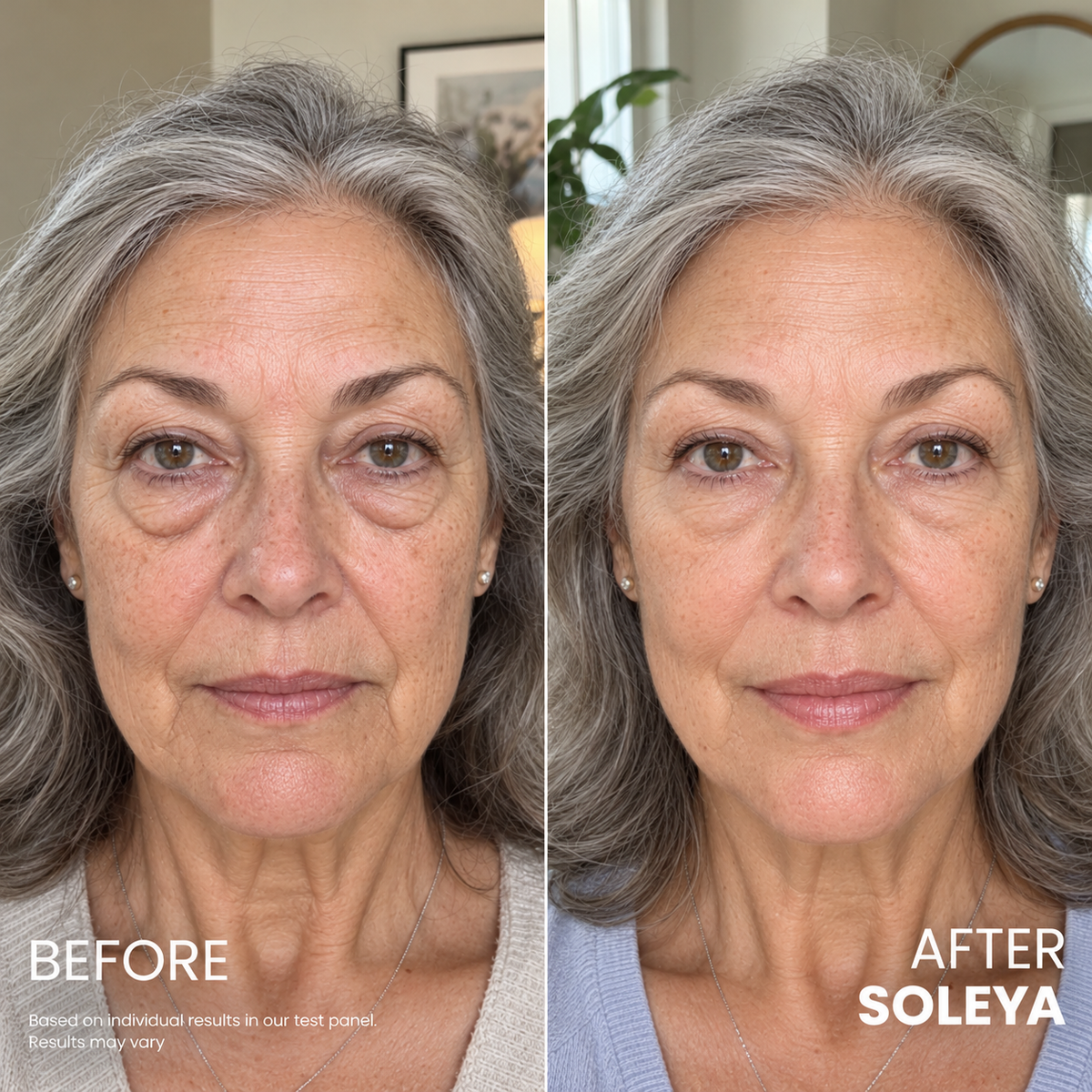 Soleya® Contour Lift Eye Cream