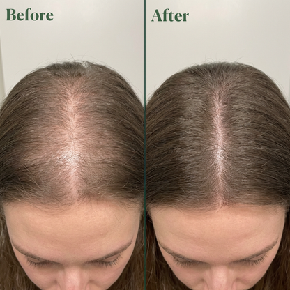 Rosemary Hydrolyzed Keratin Shampoo