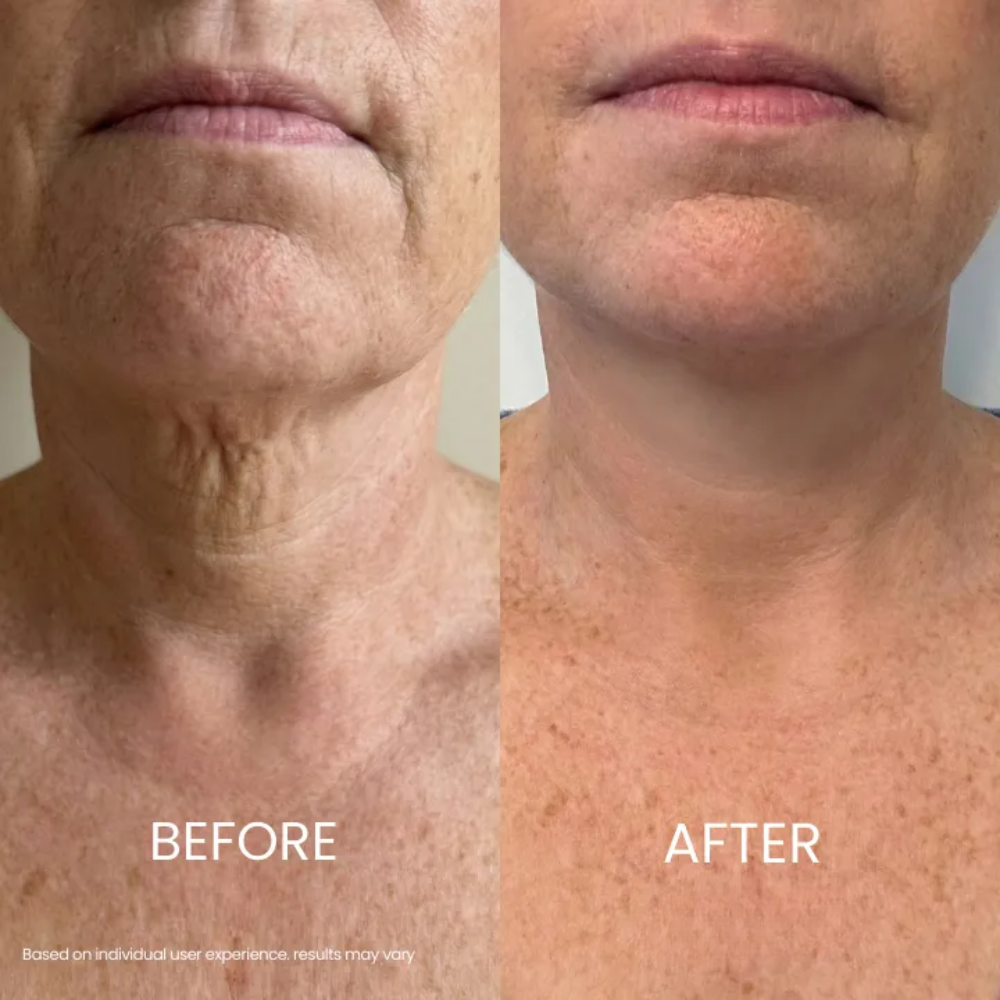 Soleya® Tighten & Lift Neck Cream