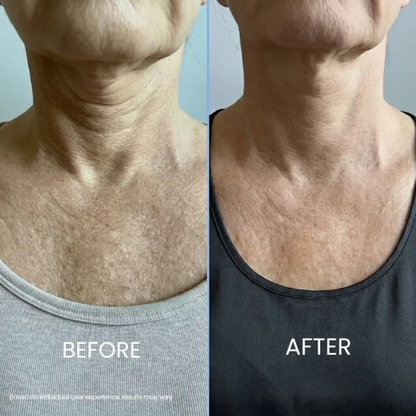 Soleya® Tighten & Lift Neck Cream