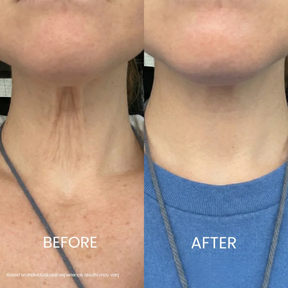 Soleya® Tighten & Lift Neck Cream