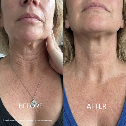 Soleya® Tighten & Lift Neck Cream